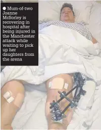  ??  ?? Mum-of-two Joanne McSorley is recovering in hospital after being injured in the Manchester attack while waiting to pick up her daughters from the arena