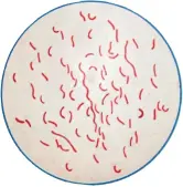  ??  ?? The bacteria that cause cholera - Vibrio cholerae