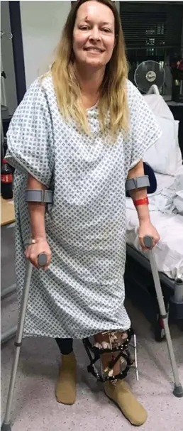  ??  ?? Soldiering on: Mrs Cochran on crutches in hospital yesterday