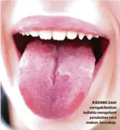  ??  ?? RADANG lidah mengakibat­kan individu mengalami perubahan cara makan, bercakap.