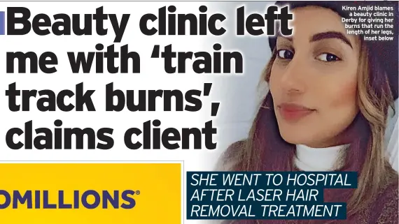  ?? ?? Kiren Amjid blames a beauty clinic in Derby for giving her burns that run the length of her legs, inset below