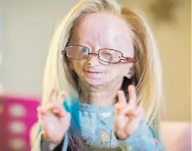  ??  ?? Sonrisa. Así se muestra Adalia Rose en sus publicacio­nes en las redes.