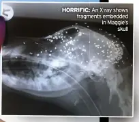  ?? ?? HoRRIFIC: An X-ray shows fragments embedded in Maggie’s skull