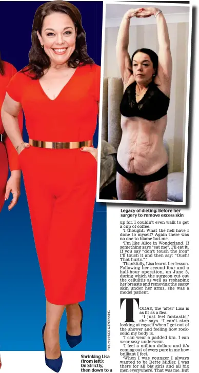  ??  ?? 2017 Shrinking Lisa (from left): On Strictly, then down to a size 12 and now, ‘feeling a million dollars’ Legacy of dieting: Before her surgery to remove excess skin