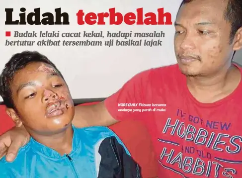 ?? FOTO: AZHAR HASHIM ?? NORSYAHLY Fidzuan bersama anaknya yang parah di muka.