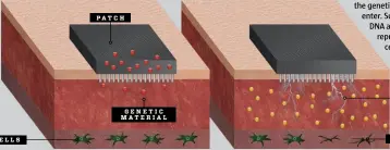  ??  ?? SKIN CELLS CURRENT NERVE CELLS PAT C H GENETIC MAT E R I A L