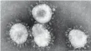  ??  ?? Under a microscope, the coronaviru­s looks like it is wearing a crown