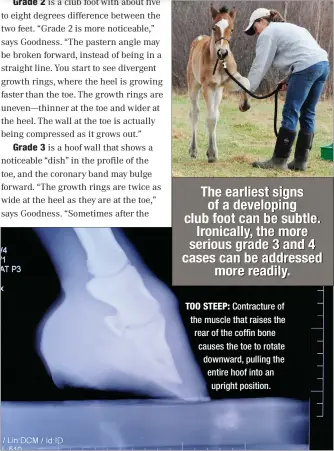  ??  ?? TOO STEEP: Contractur­e of the muscle that raises the rear of the coffin bone causes the toe to rotate downward, pulling the entire hoof into an
upright position.