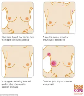  ??  ?? Women should also check for discharge from the nipple, a swelling in their armpit or collarbone, an inverted nipple or constant pain in your breast or armpit. If you spot any signs go and see your GP straight away.