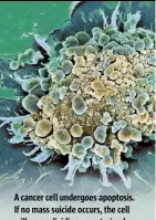  ??  ?? A cancer cell undergoes apoptosis. If no mass suicide occurs, the cell will go on dividing unrestrain­ed.