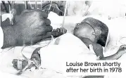  ??  ?? Louise Brown shortly after her birth in 1978