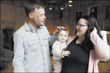  ?? Charlie Neibergall The Associated Press ?? Lilly Ross holds 17-month-old son Leonard as she talks with face transplant recipient Andy Sandness after their first meeting Friday at the Mayo Clinic in Rochester, Minn.