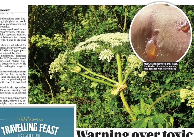  ??  ?? Main, giant hogweed and, inset, the kind of blister after coming into contact with its toxic sap