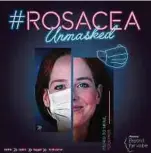  ??  ?? Die weltweite Social-Media-Kampagne #RosaceaUnm­asked will auf die Probleme von Rosacea-Patienten aufmerksam machen.