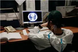  ?? FOTO: PAOLO MIRANDA/LEHTIKUVA-AFP ?? En italiensk läkare studerar en datortomog­rafibild av en patients lungor.
■