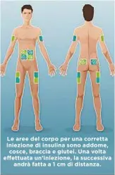  ??  ?? Le aree del corpo per una corretta iniezione di insulina sono addome, cosce, braccia e glutei. Una volta effettuata un’iniezione, la successiva andrà fatta a 1 cm di distanza.