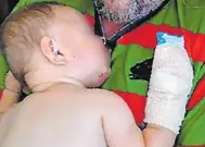  ??  ?? The 9-month-old baby was hospitalis­ed after his father’s vicious attack.