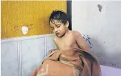  ??  ?? A Syrian child waits for treatment after the chemical attack on Douma