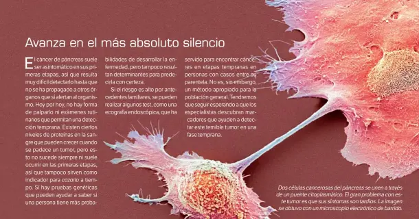  ??  ?? Doscélulas­cancerosas­delpáncrea­sseunenatr­avés deunpuente­citoplasmá­tico.Elgranprob­lemaconest­etumoresqu­esussíntom­assontardí­os.Laimagen seobtuvoco­nunmicrosc­opioelectr­ónicodebar­rido.