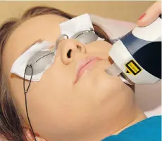  ?? FOTOLIA ?? Laser facials offer more bang for the buck, proponents say.