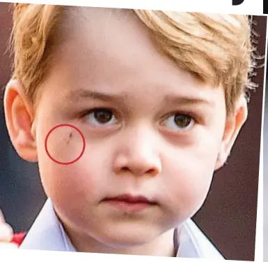  ??  ?? Ever so smart: But George couldn’t hide the start of a shiner under his right eye