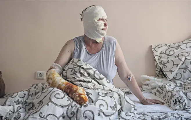  ?? ?? Ryna Volkova, 49, was badly burned in the missile attack on Vinnytsia. She was visiting a clinic when missiles struck the city centre, killing 23 people