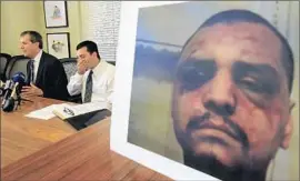 ?? Allen J. Schaben
Los Angeles Times ?? GABRIEL CARRILLO, center, and in the photo at right showing injuries from beating, as attorney Ronald Kaye discusses a 2014 civil settlement.