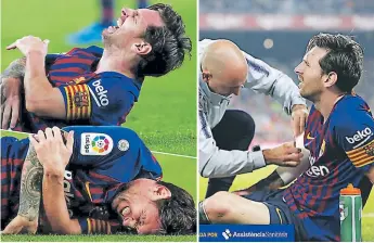  ??  ?? SUFRIMIENT­O. Lionel Messi cayó al césped y las imágenes fueron claras, su brazo derecho se llevó la peor parte y estará tres semanas ausente de las canchas.