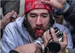  ??  ?? FALLOUT Clockwise from top left: A MAGA demonstrat­or is treated for injuries after clashing with law enforcemen­t; a rioter is detained; and police officers recover after apparently suffering from the effects of tear gas and/or pepper spray.