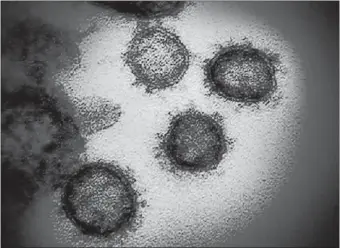  ?? ALLERGY AND INFECTIOUS DISEASES VIA TRIBUNE NEWS SERVICE] ?? This transmissi­on electron microscope image shows SARS-CoV-2, the virus that causes COVID-19, isolated from a patient in the U.S., emerging from the surface of cells cultured in the lab. [NATIONAL INSTITUTE OF