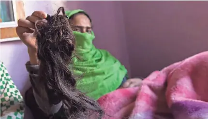  ??  ?? When Shaqeela Sajad, 24, awoke after she was attacked this month, she found her braids had been cut off. BABA TAMIM