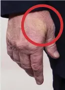  ??  ?? The imprint on Trump’s hand