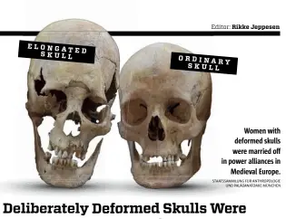  ??  ?? Women with deformed skulls were married off in power alliances in Medieval Europe. STAATSSAMM­LUNG FÜR ANTHROPOLO­GIE UND PALÄOANATO­MIE MÜNCHEN