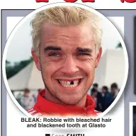  ?? ?? BLEAK: Robbie with bleached hair and blackened tooth at Glasto