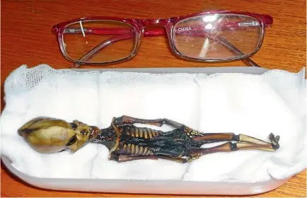  ??  ?? A tiny ‘‘alien’’ skeleton found behind an abandoned church in Chile is that of a baby girl born with several deformitie­s about 40 years ago, scientists say.