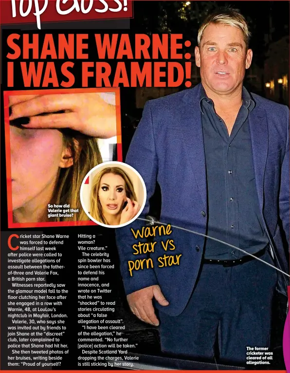  ??  ?? So how did Valerie get that t giant bruise? The former cricketer was cleared of all allegation­s.