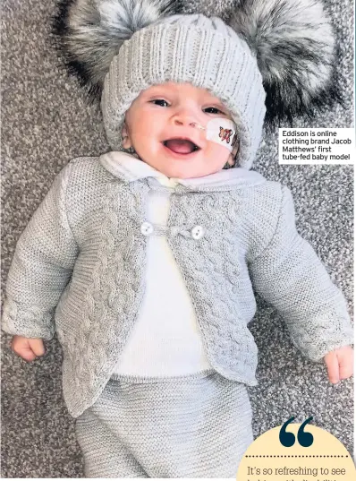  ??  ?? Eddison is online clothing brand Jacob Matthews’ first tube-fed baby model