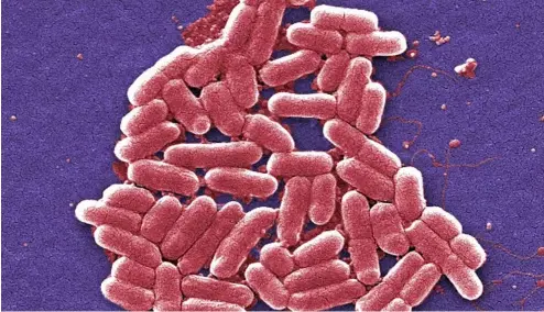 ?? ?? Cette image de micrograph­ie électroniq­ue à balayage colorisée de 2006 montre la souche O157:H7 de la bactérie E. coli.