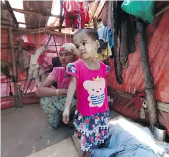  ?? TODD PITMAN / THE ASSOCIATED PRESS ?? Rosmaida Bibi, a four-year old Rohingya girl who suffers from severe malnutriti­on, stands next to her mother Hamida Begum inside a squalid tent at the Dar Paing camp in Myanmar.