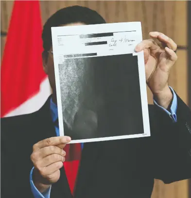  ?? SEAN KILPATRICK / THE CANADIAN PRESS FILES ?? Conservati­ve MP Pierre Poilievre holds up redacted documents tabled at the House of Commons Finance Committee
provided by the government at a press conference in Ottawa in August.