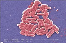  ?? JANICE CARR, CDC.GOV ?? A microscope’s E. coli image, the type of bacteria superbug recently found.
