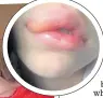  ??  ?? BEWARE: Seized fake make-up, above. Larissa Reynolds and her swollen lip, left