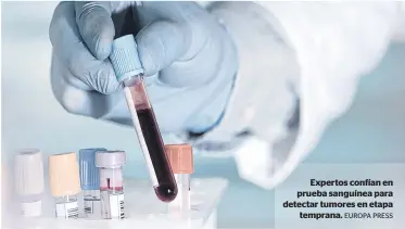  ?? EUROPA PRESS ?? Expertos confían en prueba sanguínea para detectar tumores en etapa
temprana.
