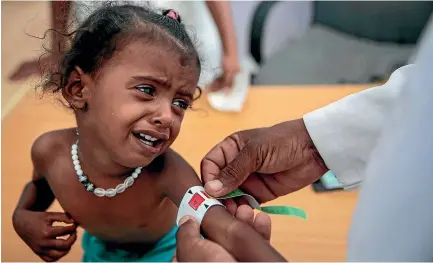  ?? AP ?? A doctor measures the arm of malnourish­ed girl at the Aslam Health Centre, Hajjah, Yemen. 70 per cent of the population is hungry according to a UN report.