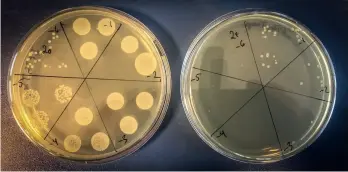  ??  ?? Biotekniik­kayritys SNIPR Biome on kehittänyt geenisaksi­in perustuvan, nopeasti toimivan menetelmän, joka säästää hyviä bakteereja (vasemmalla) mutta tuhoaa pahoja (oikealla).