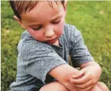  ?? ?? 異位性皮膚炎患者常見­皮膚搔癢，較大的孩童在肘凹、膕凹、腕關節、膝關節等處會出現皮疹。圖為示意圖。
(Getty Images)