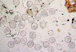  ?? A. MENZEL Y Y. YUAN, UNIVERSIDA­D TÉCNICA DE MUNICH ?? Granos de polen de hierba bajo microscopi­o óptico