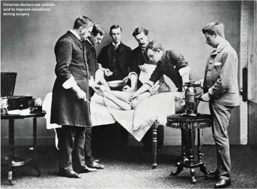  ??  ?? Victorian doctors use carbolic acid to improve cleanlines­s during surgery