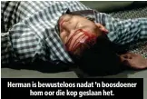  ??  ?? Herman is bewusteloo­s nadat ’n boosdoener hom oor die kop geslaan het.