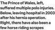  ?? ?? The Prince of Wales, left, suffered multiple polo injuries. Below, leaving hospital in 2003 after his hernia operation. Right, there have also been a few horse riding scrapes